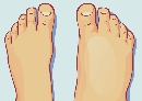 Dikke voeten en enkels: oorzaken en behandeling